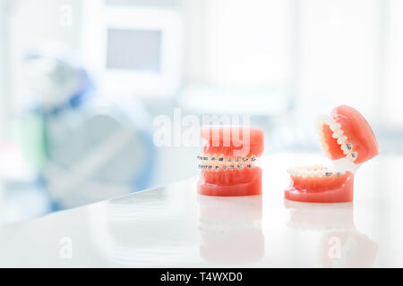 tooth model with metal wired dental braces isolated on white background ...