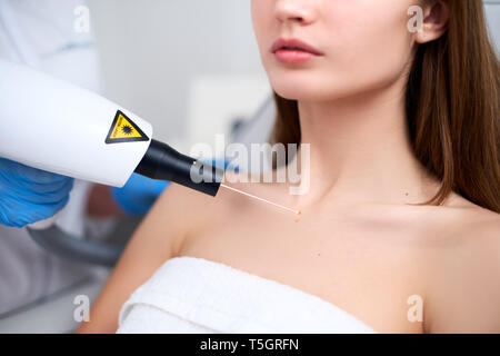 Laser mole removal on a woman's chest in a beauty salon. Hardware cosmetology. Beautician doctor removing birthmark or nevus with laser beam gun in Stock Photo