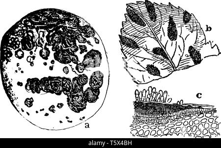 Skin Scab Diagram