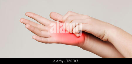 Woman scratching her itchy palm with rash Stock Photo