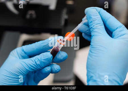 the veterinarian taking two drops of blood with the pipette from a collecting tube with heparin Stock Photo