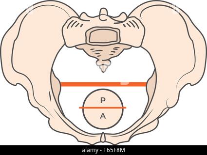 Gynecoid Pelvis Shape w Round or Circular shape Stock Vector