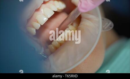 A girl sits in a dentist's office with Optragate. Stock Photo