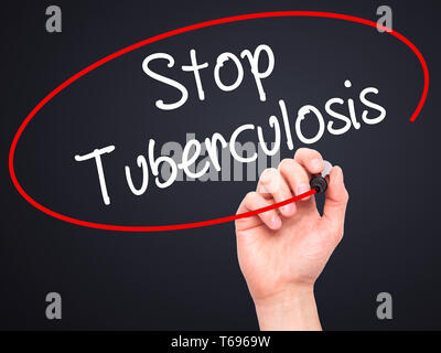 Man Hand writing Stop Tuberculosis with black marker on visual screen. Stock Photo