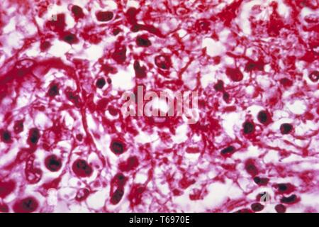 This is a photomicrograph of the fungus Hortaea werneckii, the