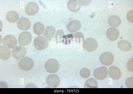 Thin film photomicrograph of a mature Plasmodium malariae trophozoite that resembles a macrogametocyte, 1965. Image courtesy Centers for Disease Control and Prevention (CDC) / Dr Mae Melvin. () Stock Photo