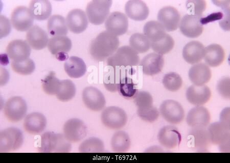 Giemsa stain thin film photomicrograph of an old growing Plasmodium malariae trophozoite, 1971. Image courtesy Centers for Disease Control and Prevention (CDC) / Dr Mae Melvin. () Stock Photo