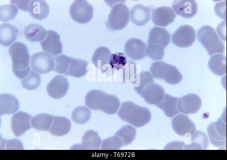 Photomicrograph Of The Malaria Parasite Plasmodium Malariae In ...