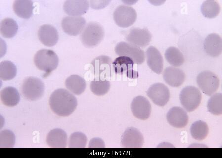 Giemsa stain thin film photomicrograph of a mature Plasmodium malariae trophozoite, 1971. Image courtesy Centers for Disease Control and Prevention (CDC) / Dr Mae Melvin. () Stock Photo