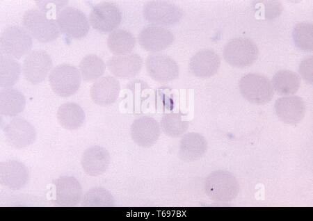 Thin film photomicrograph of a growing Plasmodium malariae bond form trophozoite, 1966. Image courtesy Centers for Disease Control and Prevention (CDC) / Dr Mae Melvin. () Stock Photo