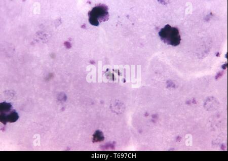 Giemsa stain thin film photomicrograph of a mature Plasmodium malariae schizont, 1971. Image courtesy Centers for Disease Control and Prevention (CDC) / Dr Mae Melvin. () Stock Photo