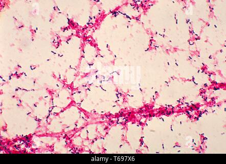 This is a photomicrograph of Streptococcus pneumoniae bacteria having been grown from a blood culture, 1978. Streptococcus pneumoniae, the bacteria responsible for pneumococcal meningitis, is very common, and normally lives in the back of the nose and throat, or the upper respiratory tract. Image courtesy CDC/Dr. Mike Miller. Stock Photo
