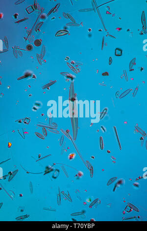 Diatoms in the water under the microskop Stock Photo