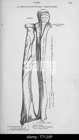 Black and white print showing the bones in a human left hand, on the ...