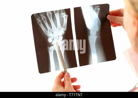 Doctor Female Hand Holding Hand Xray Photography Stock Photo