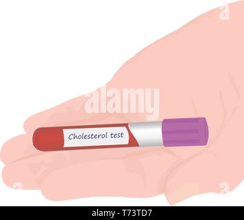 Blood cholesterol level laboratory test vector illustration Stock ...