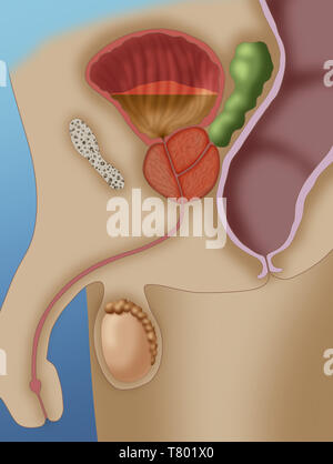 Enlarged Prostate and Hypertrophy, Illustration Stock Photo