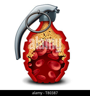 Heart disease bomb and cholesterol danger coronary artery illness as a medical concept with a live grenade inside an artery or vein with plaque. Stock Photo