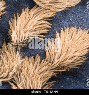 Lung Trachea Epithelium, SEM Stock Photo