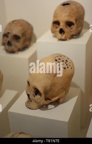 Elongated skulls of ancient Paracas people Stock Photo