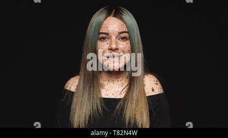 Close up of young woman looking at camera isolated on black background. Smiling woman with mole spots or freckles on her body. Stock Photo