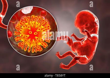 HIV infecting human embryo, illustration Stock Photo