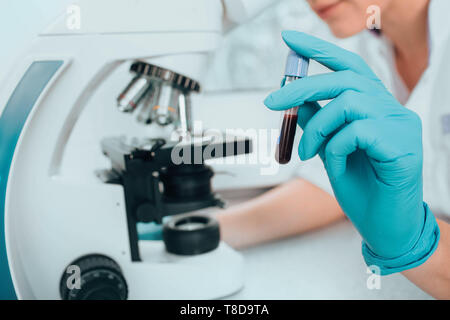 Technician holding blood samples in vial. examining a human sample using Microscope Stock Photo
