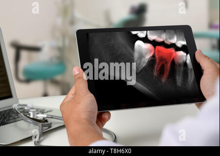 Dentist dental tool to teeth x-ray work Looking At Teeth X-ray On Computer Stock Photo