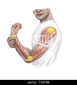 An illustration of joint man in the arm, particularly the shoulder, elbow, and wrist. Stock Photo