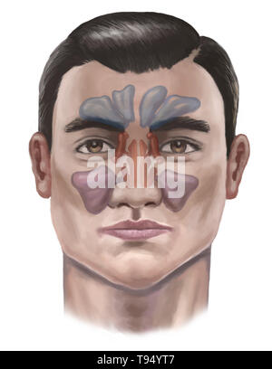 Illustration of the sinuses. From top to bottom, they include: the ...