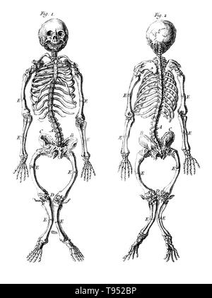 Rickets and Osteomalacia Stock Photo - Alamy