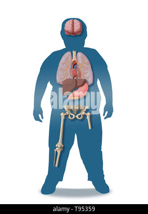 An illustration of the medical consequences of childhood obesity. Stock Photo