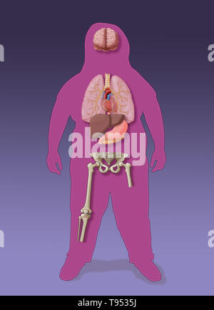 An illustration of the medical consequences of childhood obesity. Stock Photo