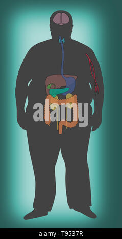 An illustration showing the cancer risks of obesity. Stock Photo