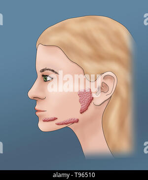 Illustration showing the location of the salivary glands in a female ...