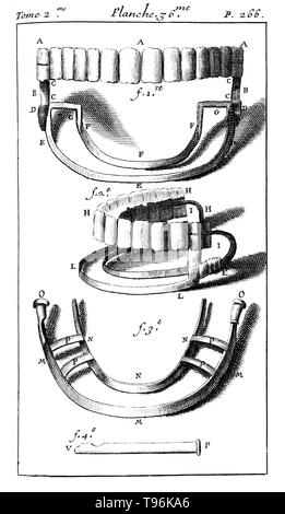 Artificial teeth with springs. A dental prosthesis comprising artificial teeth with springs. Tome 2. Planche 36. P. 266. Pierre Fauchard (1678 - March 22, 1761) was a French physician, credited as being the father of modern dentistry. He is widely known for writing the first complete scientific description of dentistry, Le Chirurgien Dentiste (The Surgeon Dentist), published in 1728. Stock Photo