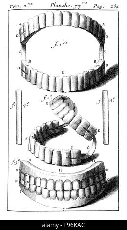 Complete set of dentures with springs. Tome 2. Planche 37. P. 284. Pierre Fauchard (1678 - March 22, 1761) was a French physician, credited as being the father of modern dentistry. He is widely known for writing the first complete scientific description of dentistry, Le Chirurgien Dentiste (The Surgeon Dentist), published in 1728. Stock Photo