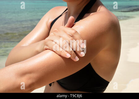 Close-up Of A Woman Applying Sunscreen Lotion On Her Arm At Beach Stock Photo