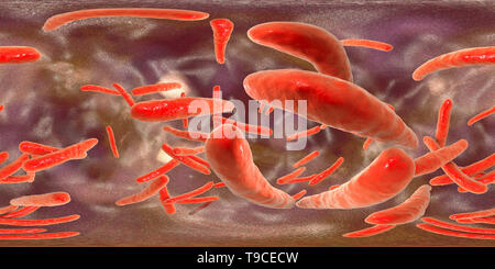 Tuberculosis Bacteria, Illustration Stock Photo - Alamy