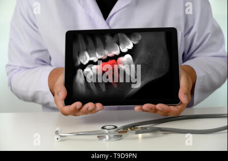 Dentist dental tool to teeth x-ray work Looking At Teeth X-ray On Computer Stock Photo