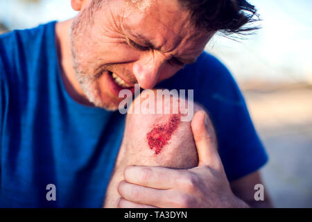 Emergency accident open abrasion wound trauma skin leg knee. People, healthcare and medicine concept Stock Photo