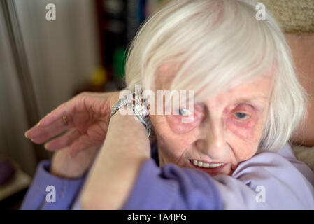 macular degeneration makes life difficult so this speaking wrist watch helps by audibly telling you the time. for visually impaired people. Stock Photo