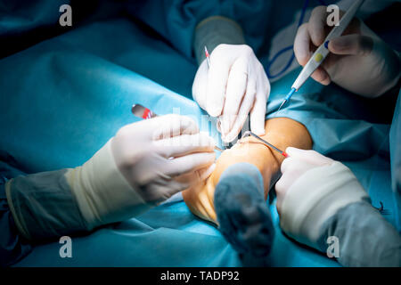 Doctors performing an ankle operation in hospital Stock Photo