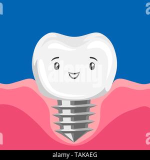 Illustration of smiling tooth implant. Stock Vector