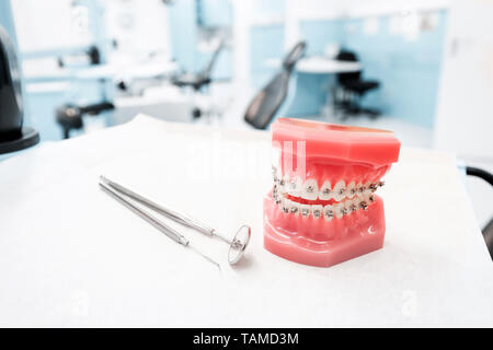 dental model with braces - Teeth orthodontic dental model with dental braces in dentist clinic Stock Photo