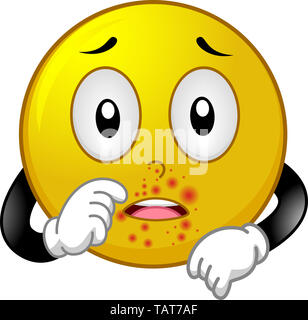 Illustration of a Smiley Mascot with Impetigo or Skin Infection Stock Photo