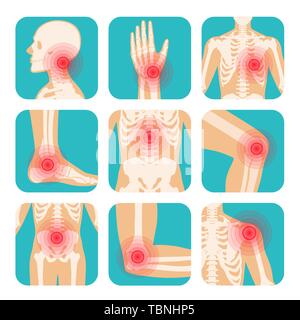 Set of red circle pain localization, human body, skeleton, joints and bones Stock Vector