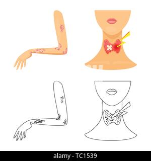 psoriasis,endocrine,dermatitis,system,skin,neck,rash,anatomy,itch,body,sick,human,allergy,thyroid,stress,treatment,hand,gland,medical,pain,dermatology,disease,healthcare,set,vector,icon,illustration,isolated,collection,design,element,graphic,sign, Vector Vectors , Stock Vector