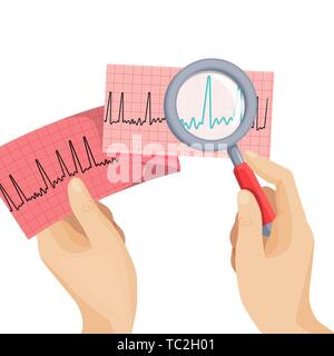 Look on atrial fibrillation through magnifying glass that human hand holds in round vector picture on white. Long piece of paper with ECG scheme of im Stock Vector