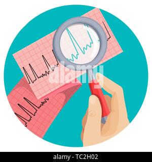 Look on atrial fibrillation through magnifying glass that human hand holds in round vector picture on white. Long piece of paper with ECG scheme of im Stock Vector